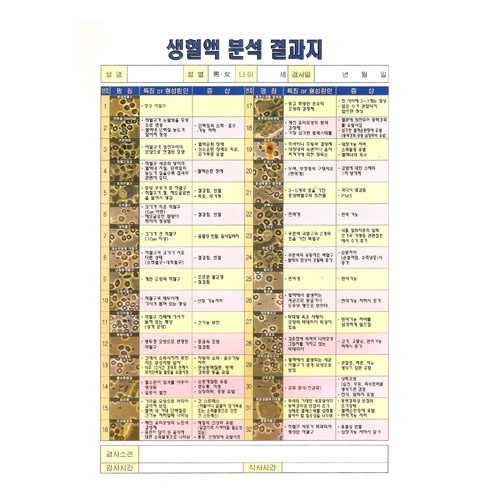 생혈액분석결과지(100매)<br>현미경진단기